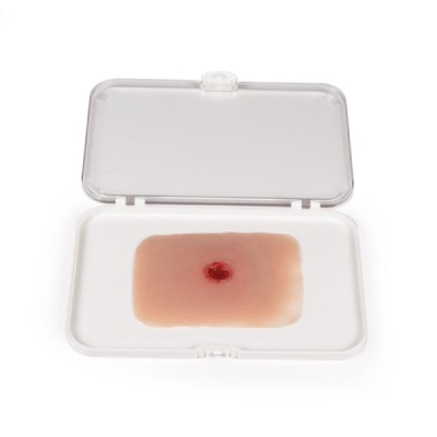 Erler-Zimmer Bullet Entry Wound Moulage